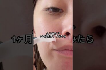 ほうれい線や首のシワが気になる人絶対に見てください‼️ #肌質改善 #シワ改善 #ほうれい線 #首のシワ #北海道PDRMクリーム # pr