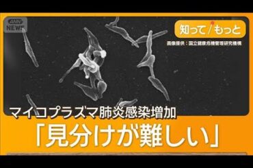 マイコプラズマ肺炎が増加　インフルと似た症状　 百日せきと同時感染も【知ってもっと】【グッド！モーニング】(2025年10月24日)