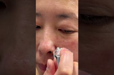 美容針が30万本入ってる本当に美肌になるって噂のKATANニードルショット、検証してみました！#50代美容 #シミケア #毛穴ケア #毛穴改善 #pr