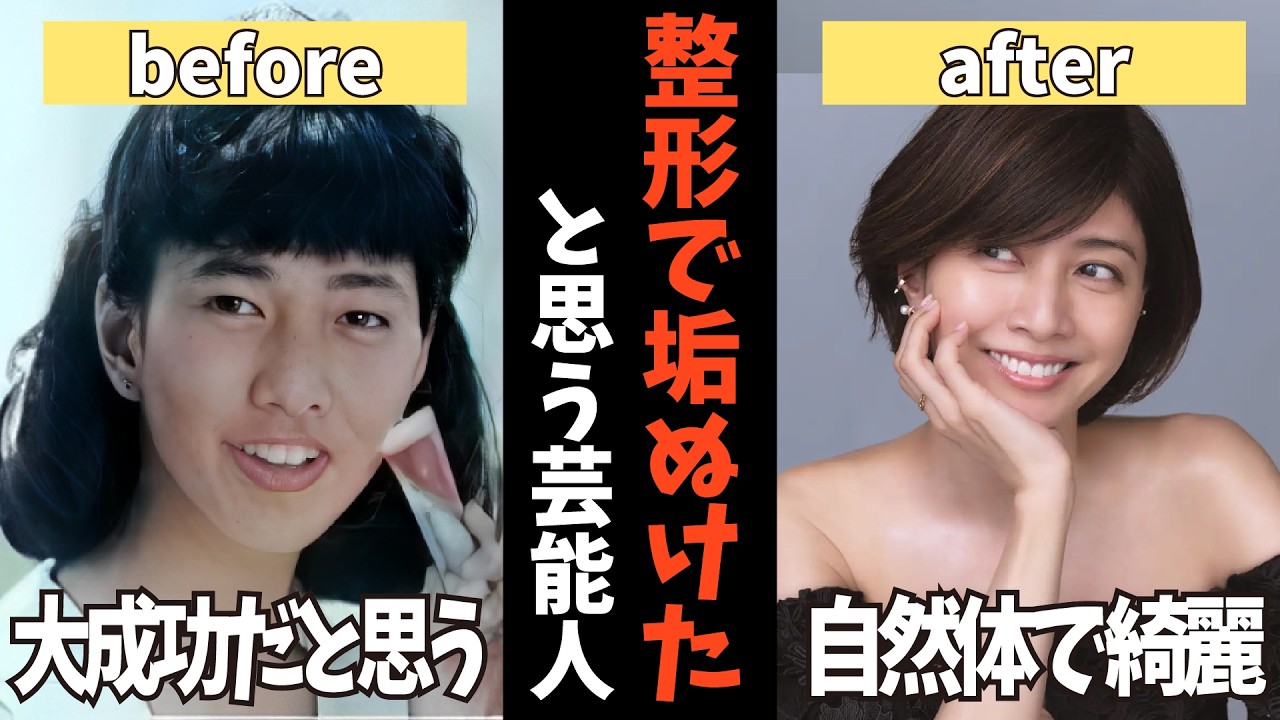 【ガルちゃん】整形で垢抜けた!?芸能人の衝撃ビフォーアフター【有益2ch】 【ガルちゃん】整形で垢抜けた!?芸能人の衝撃ビフォーアフター【有益2ch】
