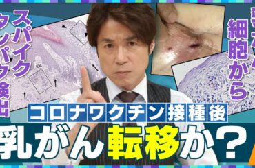 【大石解説】コロナワクチン接種後に乳がん転移！？／高齢患者と主治医を直撃！患者の体に一体何が…？／接種開始後にがん死者数”下げ止まり”とのデータも