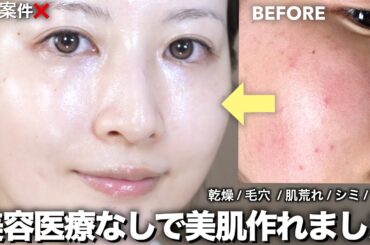 【最新スキンケア】美容医療なしで圧倒的美肌になったスキンケアルーティン全部紹介！【乾燥/毛穴/肌荒れ/シミ】