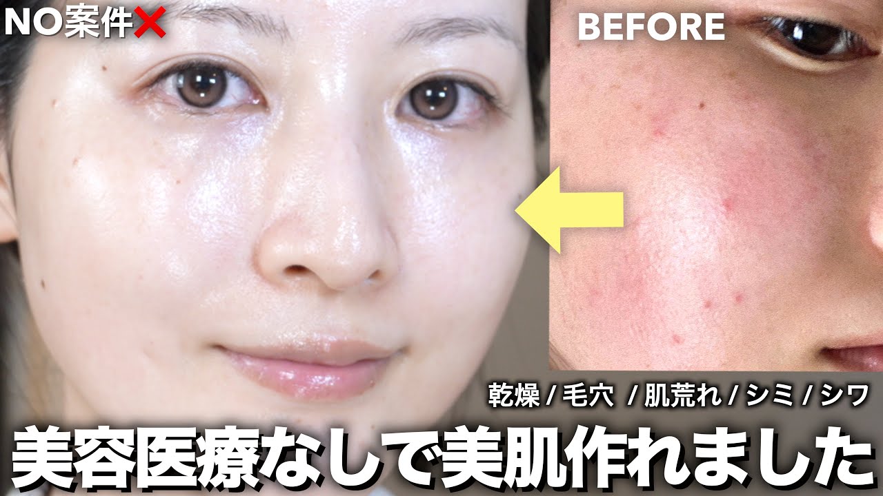 【最新スキンケア】美容医療なしで圧倒的美肌になったスキンケアルーティン全部紹介!【乾燥/毛穴/肌荒れ/シミ】 【最新スキンケア】美容医療なしで圧倒的美肌になったスキンケアルーティン全部紹介!【乾燥/毛穴/肌荒れ/シミ】