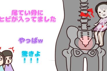 【 perfume NTY】あ〜ちゃん骨折(ひび)事件【紙芝居】