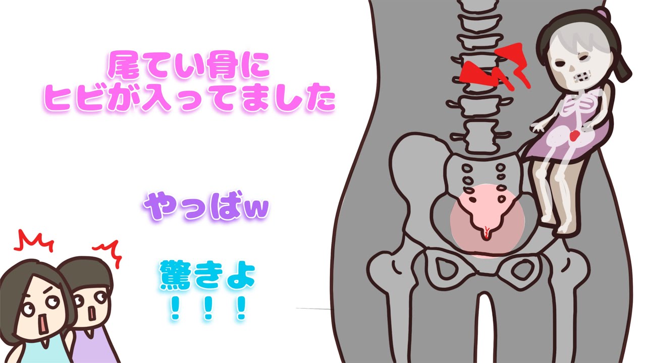 【 perfume NTY】あ〜ちゃん骨折(ひび)事件【紙芝居】 【 perfume NTY】あ〜ちゃん骨折(ひび)事件【紙芝居】