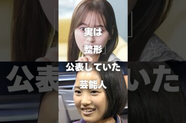 【注目】実は「整形」を公表していた芸能人まとめ#shorts #芸能人 #芸能