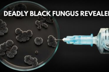 BEWARE of BLACK FUNGUS Post-COVID | Mucormycosis Explained - Causes, Symptoms & Prevention