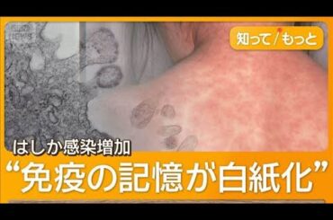 はしか感染が世界的に増加　先進国でも1000人に1人死亡　細胞破壊し「免疫白紙化」も【知ってもっと】【グッド！モーニング】(2026年1月7日)