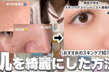 【垢抜けたい人必見‼️】美容オタクが肌を綺麗にするためにしたこと📝スキンケアスペシャリストが解説🔍🗣️ #スキンケア＃毛穴ケア＃ニキビケア＃美容#垢抜け