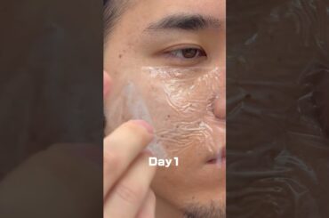 片側だけずっと使ってみた！#メンズ美肌 #毛穴ケア #スキンケア #肌質改善 #黒ずみ毛穴 pr