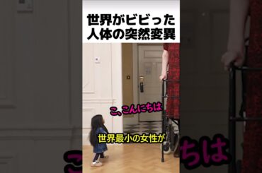 世界がビビった人体の突然変異