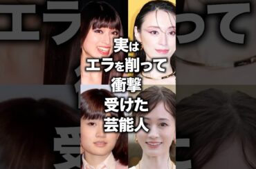 実はエラを削って衝撃受けた芸能人！