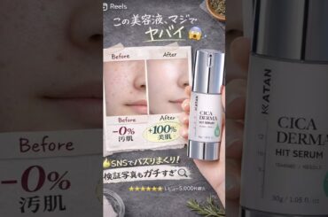 【保存必須】美容液迷子の人は1回これ使ってみて欲しいです🙂‍↕️(pr)