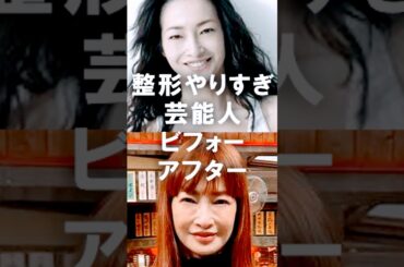 整形やりすぎた芸能人のビフォアフ画像教えてｗ【ガルちゃん芸能・有益2ch】