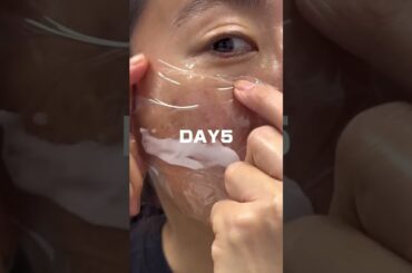 この肌やるしかねーな！話題のPDRNクリームで美肌作っていく！#美容 #自分磨き #アラフォー #美肌 #エイジングケア pr