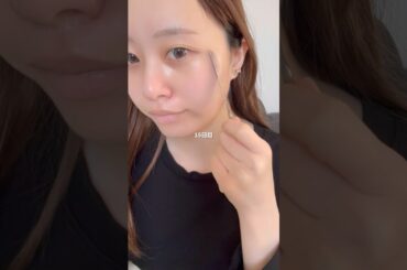 【美肌になりたい人必見】シミやニキビ肌から褒められ肌になれた理由はこれ❣️pr