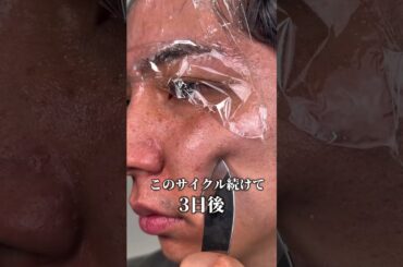 男の第一印象、肌で変わる