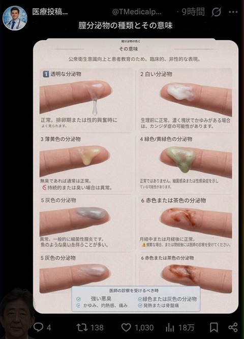 【画像】まんさんから出る液体、多種多様ｗｗｗｗｗｗｗｗ