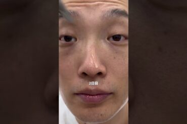大学デビューまでに美肌になりたい男の2週間本気スキンケア#美容 #クレンジング #肌質改善 #毛穴 #黒ずみ pr