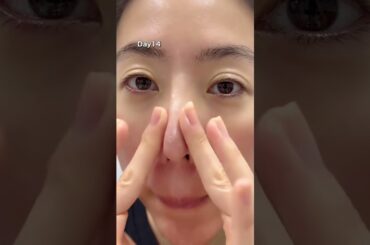 20代の肌に戻りたくて話題の美容液使ってみた‼️#美容 #アラフォー #美肌 #シミ #シワ pr