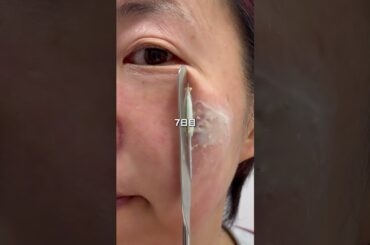 めっちゃバズってるこれ‼️片側だけ美容液試してみたよ#美容 #アラフォー #美肌 #シミ #シワ pr