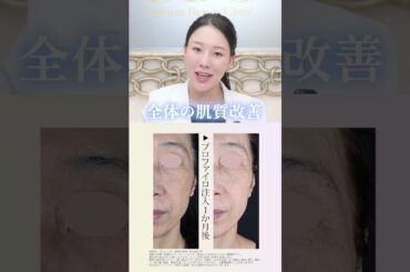 【肌育注射】プロファイロで肌の土台から若返る美肌タルミ治療【NEWタイプヒアルロン酸】湘南美容クリニック西川礼華@10yearsback