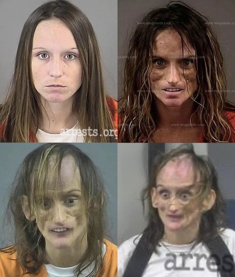 【画像】覚醒剤を15年間やり続けた女性の風貌、やばすぎる