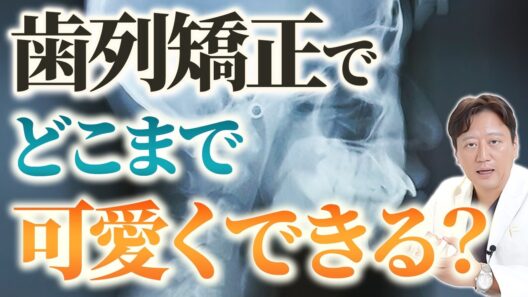 歯列矯正でどこまで可愛くなる？出っ歯・横顔の変化・美人顔の限界と現実【矯正 歯並び】