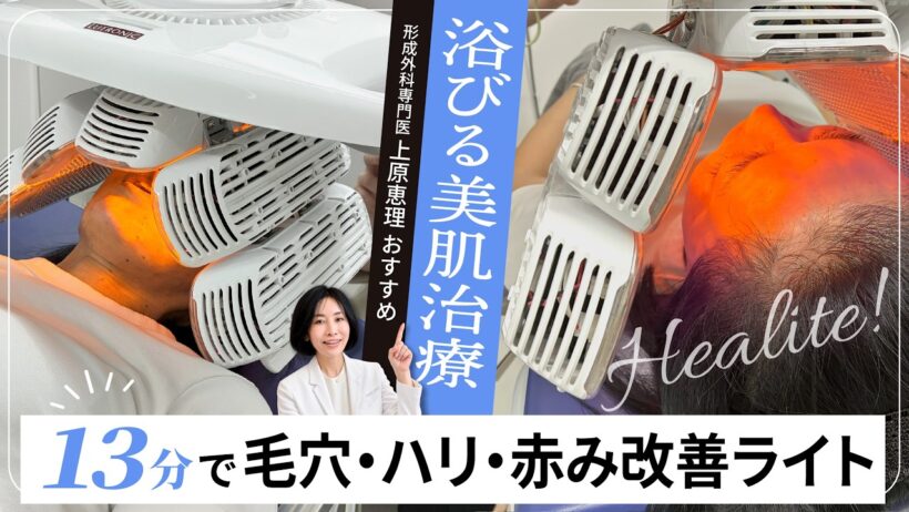 美肌だけじゃない！手術後の腫れなどにも効く光治療「ヒーライト」の正体